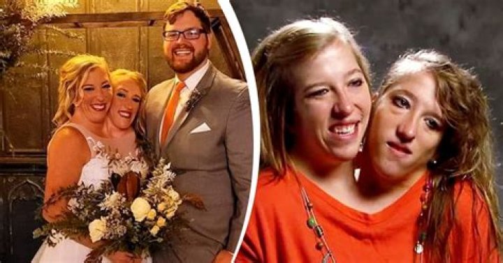 Abby and Brittany Hensel Sad News: Remembering a Remarkable Life