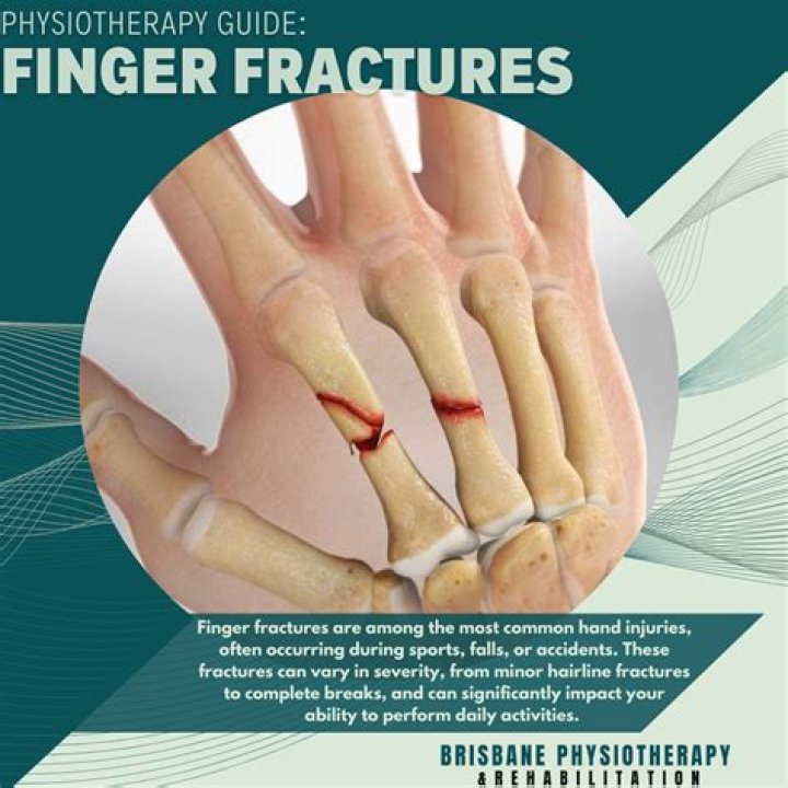 Brodie Moss Finger Injury: What Happened and What's Next for the Adventurer