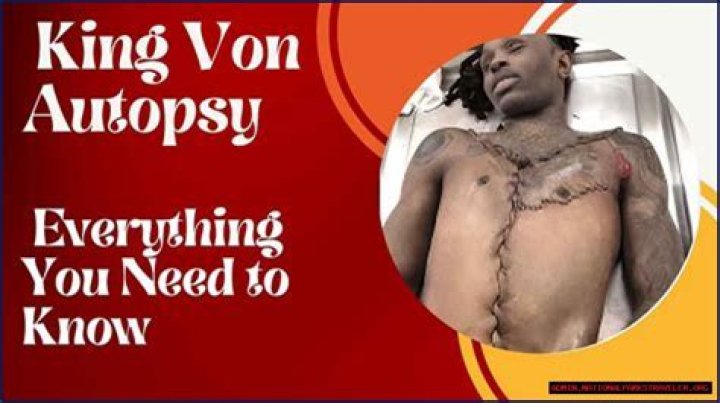 King Von Autopsy: Shocking Details Revealed