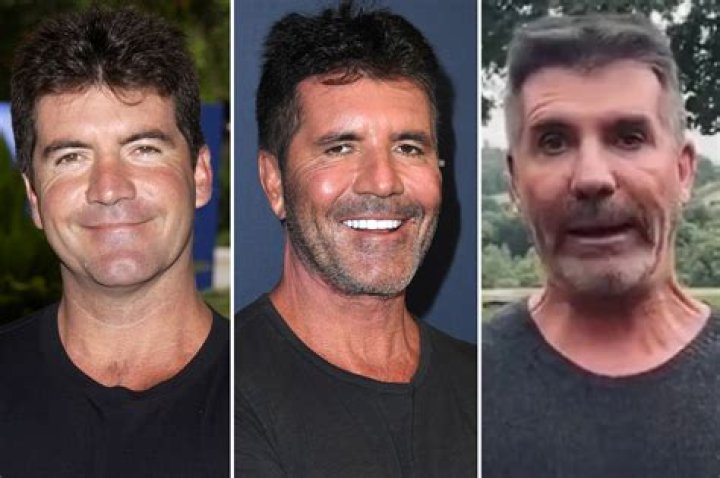 Simon Cowell Health: What's Been Happening with the TV Star?