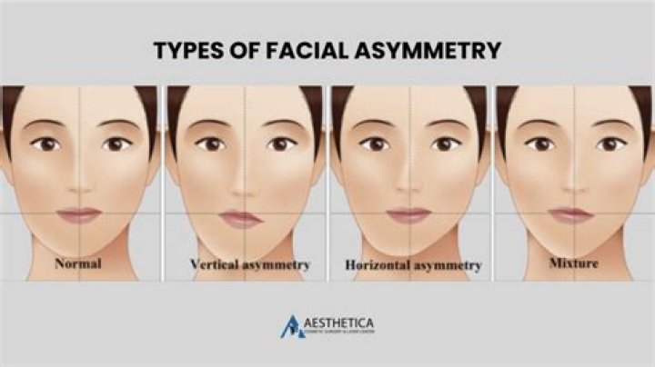 Simple Ways to Balance an Uneven Face: Your Guide to Addressing Asymmetry