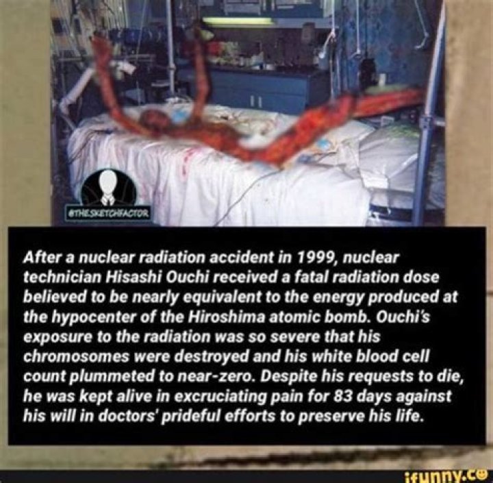 The Enduring Story Behind the Hisashi Ouchi Photo: Lessons from a Nuclear Tragedy