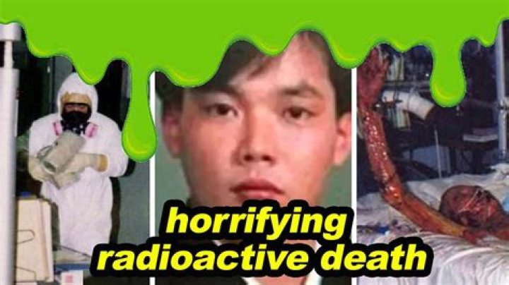 Understanding Hisashi Ouchi's Injuries: A Look at the Tokaimura Accident
